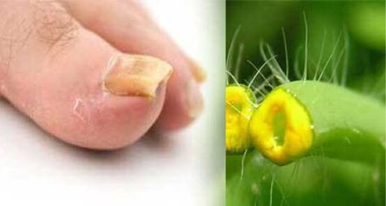 Celandine herb for toenail fungus.