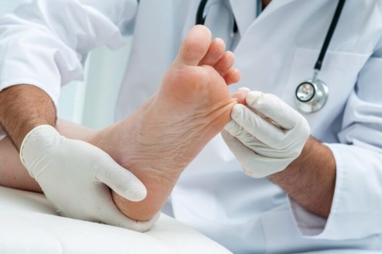 Examination of the feet by a dermatologist.