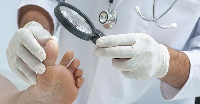 The doctor will prescribe a remedy for toenail fungus after diagnosing the disease. 