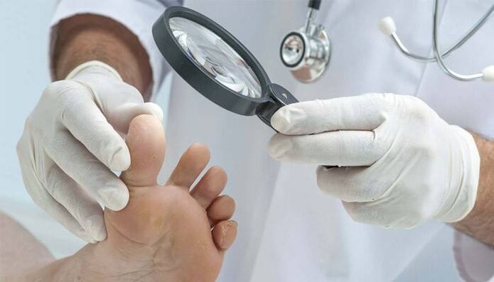 foot exam to detect fungus between the toes