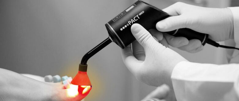Laser treatment for toenail fungus.